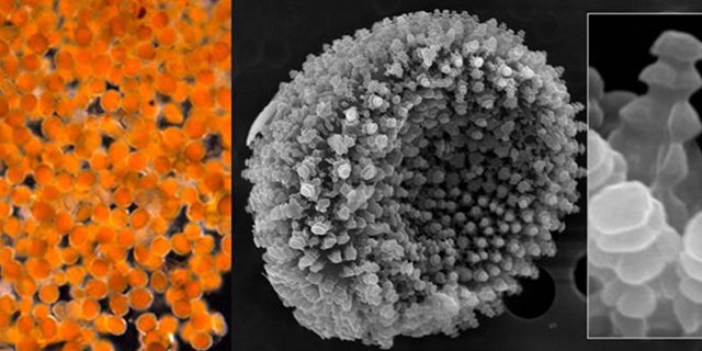 A magnified views of an orange goo that appeared Aug. 3, 2011 along the shore of the village of Kivalina, Alaska. The goo turned out to be fungal spores, not millions of microscopic eggs as indicated by preliminary analysis, scientists said Thursday, Aug. 18, 2011.