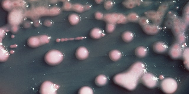 In this undated photo provided by the Centers for Disease Control and Prevention is one form of CRE bacteria, sometimes called nightmare bacteria. CRE bacteria is blamed for 600 deaths each year, and can withstand treatment from virtually every type of antibiotic. (AP Photo/Centers for Disease Control and Prevention)
