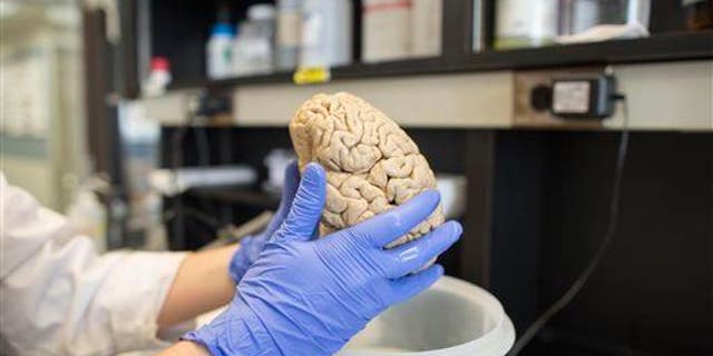 In this July 29, 2013 photo, a researcher holds a human brain in a laboratory at Northwestern University's cognitive neurology and Alzheimer's disease center in Chicago.