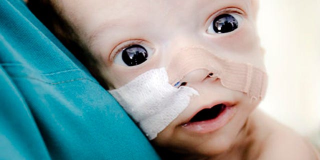 Baby Andrei, a Romanian baby born with virtually no intestines who confounded doctors by clinging to life and captured international attention for his fighting spirit, has died. (AP Photo/Vadim Ghirda, file)