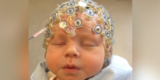 Baby undergoing electroencephalography.