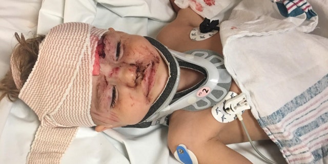 Kayden Blodgett, 2, was injured after a Tennessee deputy allegedly hit him with their cruiser, the boy's family says.