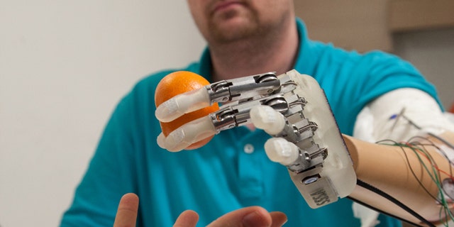 This March 2013 handout photo provided by Science Translational Medicine shows amputee Dennis Aabo Sørensen holding an orange while wearing sensory feedback enabled prosthesis in Rome. To feel what you touch _ that's the holy grail for artificial limbs. In a step toward that goal, European researchers created a robotic hand that let an amputee feel differences between a bottle, a baseball and a mandarin orange. (AP Photo/Patrizia Tocci, Science Translational Medicine)