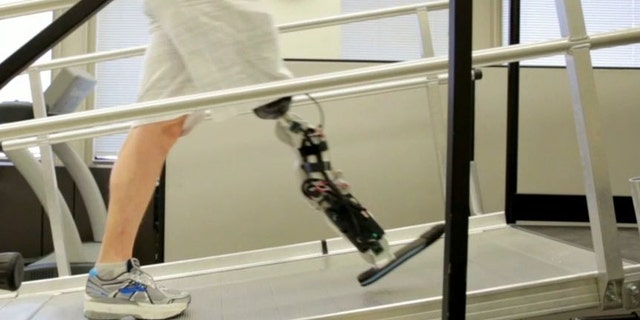 Zac Vawter, who lost his leg below the knee after a motorcycle accident four years, is the first amputee with a thought-controlled bionic leg.