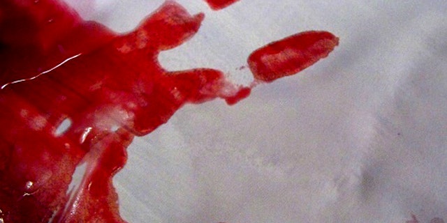 Calculating the speed at which drops of blood leave the body during an attack is an important measurement for blood pattern analysis.