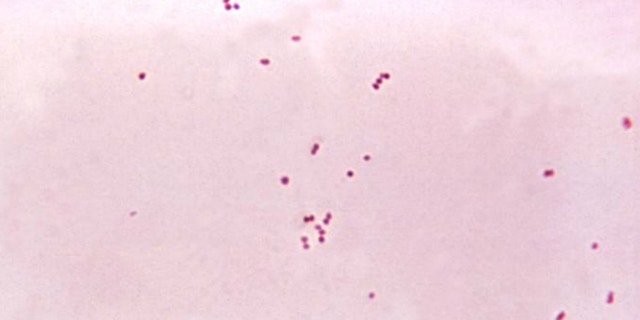 This micrograph depicts the presence of aerobic Gram-negative Neisseria meningitidis diplococcal bacteria