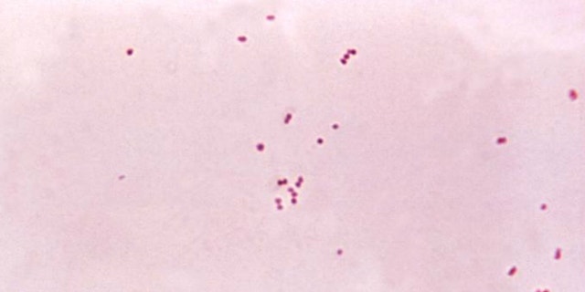 This micrograph depicts the presence of aerobic Gram-negative Neisseria meningitidis diplococcal bacteria