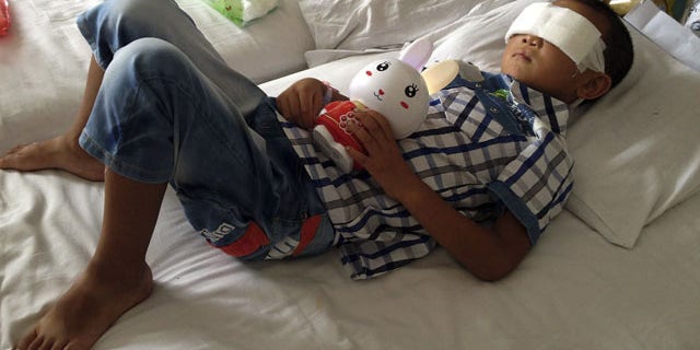 August 28, 2013: Guo Bin lies on a bed in a hospital as he recuperates from an attack in the rural area of Linfen city that left him blind, in Taiyuan in northwest China's Shanxi province. (AP Photo)