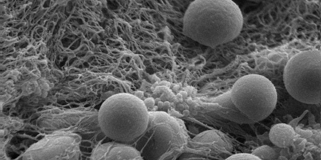 Hemostatic nanoparticles accumulate on a clot-stabilizing mesh of fibrin the body produces.