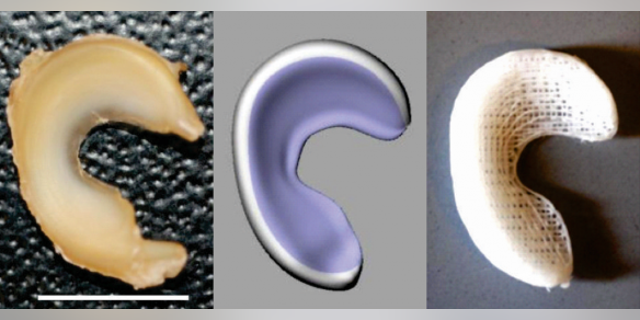 Left to right: Sheep meniscus; 3-D model of meniscus obtained from laser scanning; 3-D printed anatomically correct meniscus scaffold.