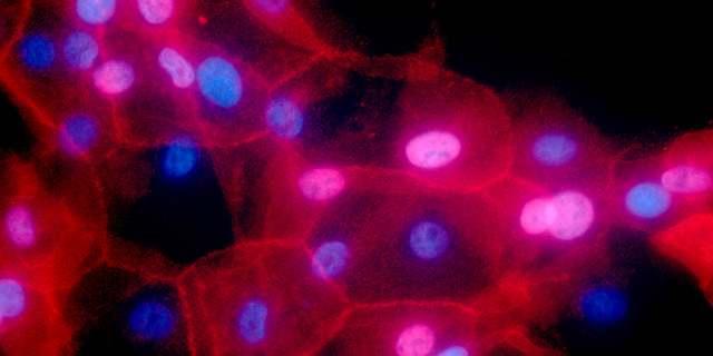 The technique is aimed at easing a frustrating problem in genetic testing.