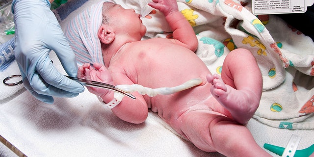 ‘Lotus birth’: Apa yang dikatakan para ahli tentang pemotongan tali pusat
