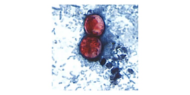 A pair of oocysts of Cyclospora cayetanensis stained with safranin.