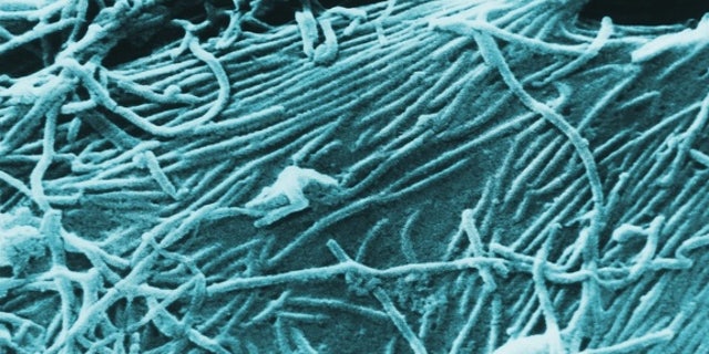 A scanning electron micrograph of the Ebola virus.