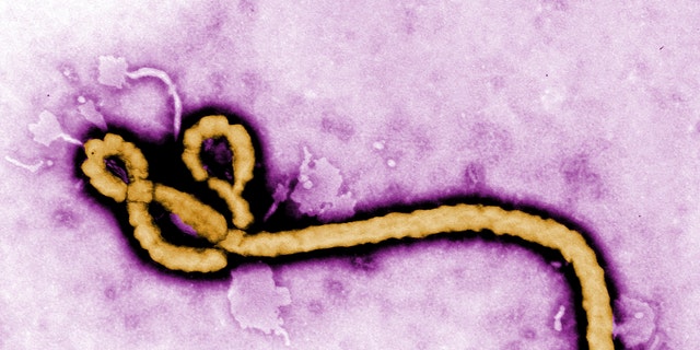 Some of the ultrastructural morphology displayed by an Ebola virus virion is revealed in this undated handout colorized transmission electron micrograph (TEM) obtained by  Reuters August 1, 2014.  The 2014 Ebola outbreak is the worst since the disease was discovered in the mid-1970s, with 729 deaths in four different countries.  REUTERS/Frederick Murphy/CDC/Handout via Reuters  (UNITED STATES - Tags: HEALTH) THIS IMAGE HAS BEEN SUPPLIED BY A THIRD PARTY. IT IS DISTRIBUTED, EXACTLY AS RECEIVED BY REUTERS, AS A SERVICE TO CLIENTS. FOR EDITORIAL USE ONLY. NOT FOR SALE FOR MARKETING OR ADVERTISING CAMPAIGNS. MANDATORY CREDIT - RTR40YMW