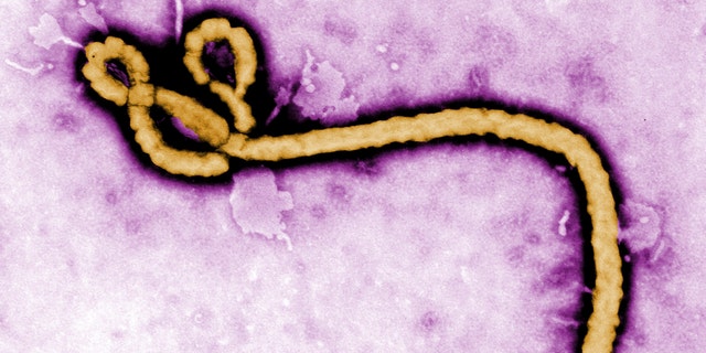 Some of the ultrastructural morphology displayed by an Ebola virus virion is revealed in this undated handout colorized transmission electron micrograph (TEM) obtained by Reuters August 1, 2014. The 2014 Ebola outbreak is the worst since the disease was discovered in the mid-1970s, with 729 deaths in four different countries. REUTERS/Frederick Murphy/CDC/Handout via Reuters (UNITED STATES - Tags: HEALTH) THIS IMAGE HAS BEEN SUPPLIED BY A THIRD PARTY. IT IS DISTRIBUTED, EXACTLY AS RECEIVED BY REUTERS, AS A SERVICE TO CLIENTS. FOR EDITORIAL USE ONLY. NOT FOR SALE FOR MARKETING OR ADVERTISING CAMPAIGNS. MANDATORY CREDIT - RTR40YMW