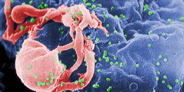 (Cynthia Goldsmith/Centers for Disease Control and Prevention via AP)
