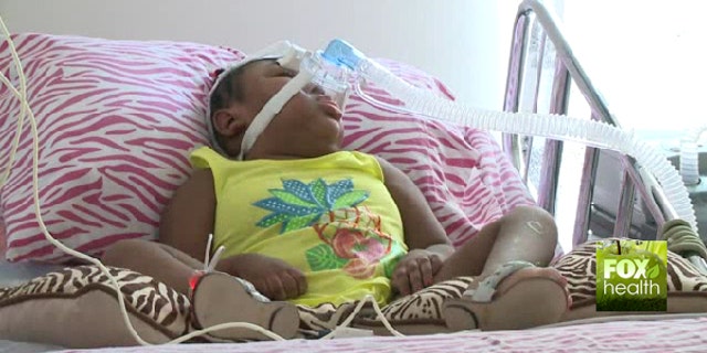 Kaliysha, 6, shown here, was born without a brain.