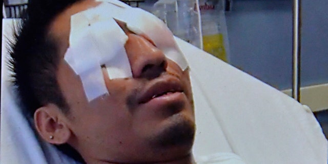 Luis-Morales says his depth perception has suffered as a result of the exploding beer bottle, and claims he "can't even fill up a cup."