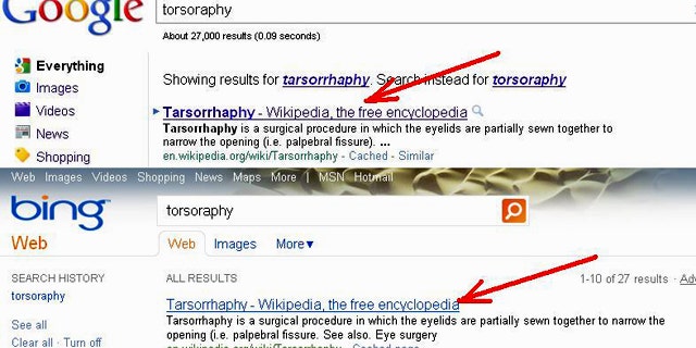 At left, Google searched for the correct spelling of "tarsorrhaphy" even though "torsoraphy" was entered. Bing manages to list the same Wikipedia entry at the top of its results.