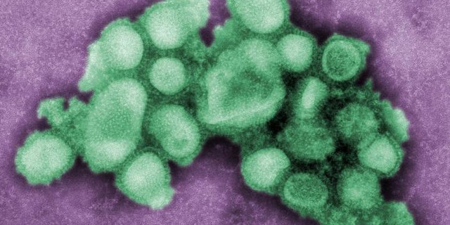 Negative stain EM image of the 2009 H1N1 influenza.