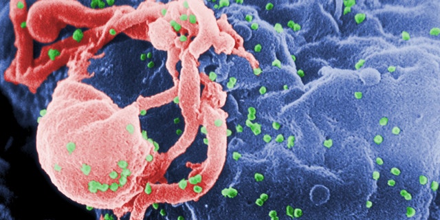 Scanning electron micrograph of HIV-1 budding from cultured lymphocyte. The multiple round bumps on cell surface represent sites of assembly and budding of virions.