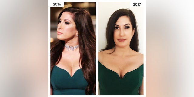 "Real Housewives of New Jersey" star Jacqueline Laurita's results after getting Ideal Implant.