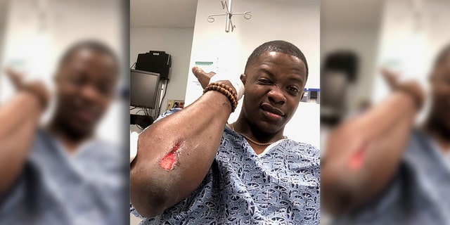 James Shaw Jr. was was grazed by a bullet on his elbow.