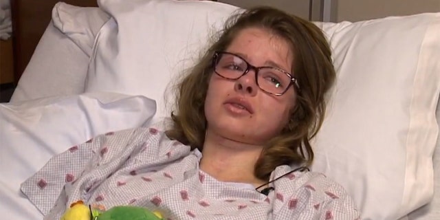Jessica Tilton said she endured the "worst pain I've ever felt" after she was hit by a lava bomb.