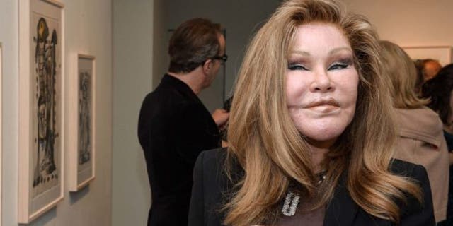 Jocelyn-Wildenstein