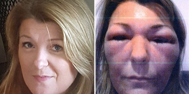 Sheppard allegedly texted Bolster about her symptoms and was allegedly told "it always goes down though."