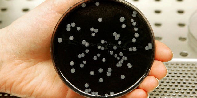 A technician holds a culture dish with colonies of legionella in a laboratory.