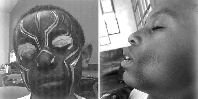 A mother has filed a lawsuit claiming her son developed a significant skin reaction after getting his face painted at Legoland, according to complaint documents.