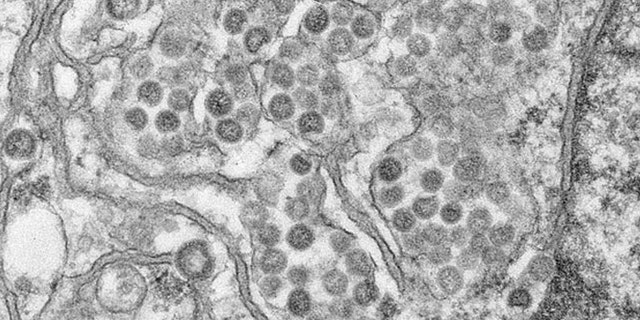 An electron micrograph of a thin section of MERS-CoV, showing the spherical particles and cross-sections through the viral nucleocapsid.