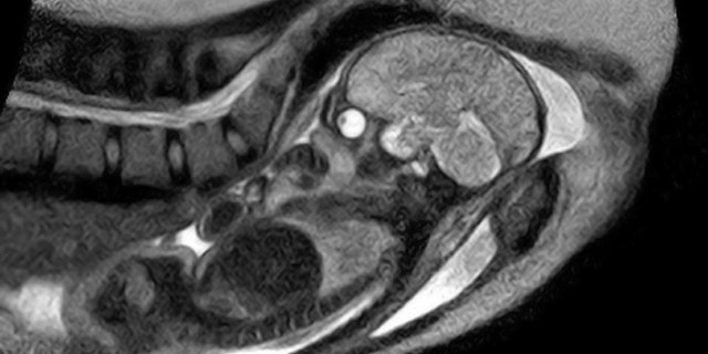 Researchers hope the new machine will allow them to study in “greater detail” how the baby moves through the birth canal, which should help them understand why a growing number of women end up needing a caesarean section.