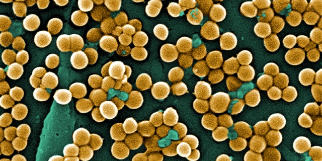 This colorized scanning electron micrograph (SEM) depicts numerous clumps of methicillin-resistant Staphylococcus aureus (MRSA) bacteria. It is especially dangerous because it is resistant to many antibiotics.