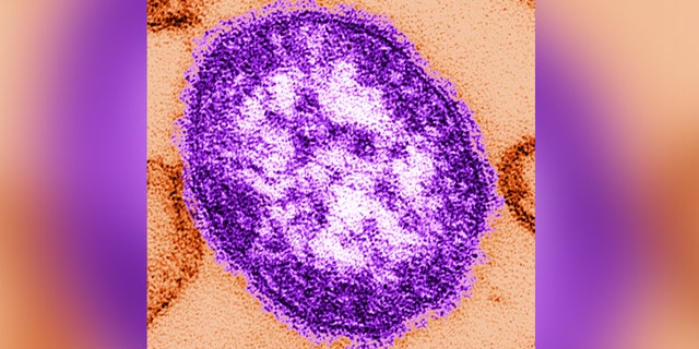 This thin-section transmission electron micrograph (TEM) reveals a single virus particle, or virion, of measles virus.