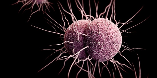 Antibiotic-resistant gonorrhea, shown here, spreads easily and symptoms are often missed. (CDC)