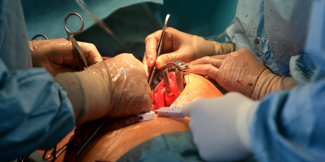 A Tennessee man died roughly a month after a surgeon lost a surgical needle inside his body while performing open-heart surgery.