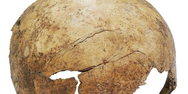 Photo released Monday Aug. 17, 2015 by researcher Christian Meyer shows the fractured skull of an about eight-years-old child with a digital mark to show the size.