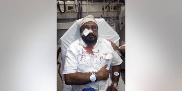 In this Sept. 8, 2015 photo provided by The Sikh Coaliton, 53-year-old Inderjit Mukker is seen at a hospital in Hinsdale, Ill., following an attack authorities say was a road rage incident in Darien, Ill. On Tuesday, Sept. 15, prosecutors said a suburban Chicago teenager who had already been charged with punching the Sikh man has now been charged with a hate crime. (The Sikh Coalition via AP)