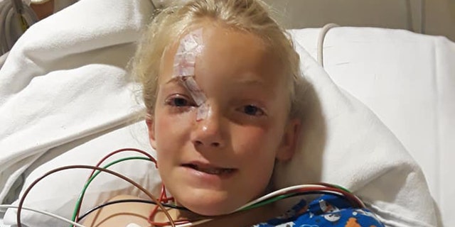 A tool got caught in the mower's blade, causing it to dislodge and hit Skylar in the face.