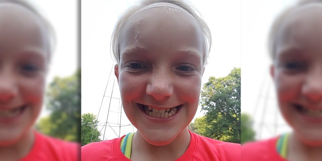 Skylar suffered a skull fracture and 200 stitches to close the wound.
