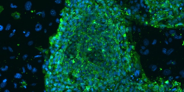 A fluorescent microscope image shows human embryonic stem cells in this photo taken at Stanford University and released by the California Institute for Regenerative Medicine.