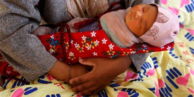 Four-day-old infant is shown.