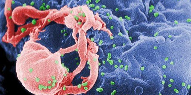A scanning electron micrograph of multiple round bumps of the HIV-1 virus on a cell surface.