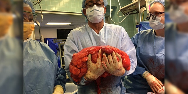 “It’s one thing to see the picture. It’s another thing to actually have it in your hands,” said Daly’s surgeon, Dr. Julio Teixeira.