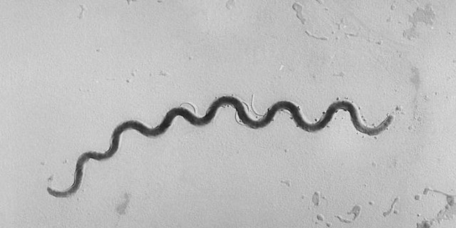 This photomicrograph depicts a Treponema pallidum bacterium, a spirochete 5 to 15 micrometers in length, which is the causative agent of syphilis.