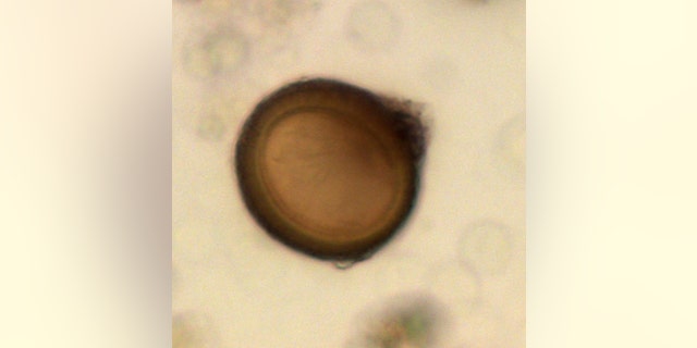 Two of the stools had low numbers of tapeworm eggs (Taenia), which have a round shape, thick walls with striations and a brown color.