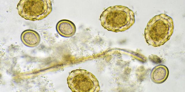 Eggs of helminthes in stool, analyze by microscope
